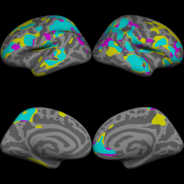 Lateral and Medial, Right and Left view of a brain surface with 3 color maps overlayed